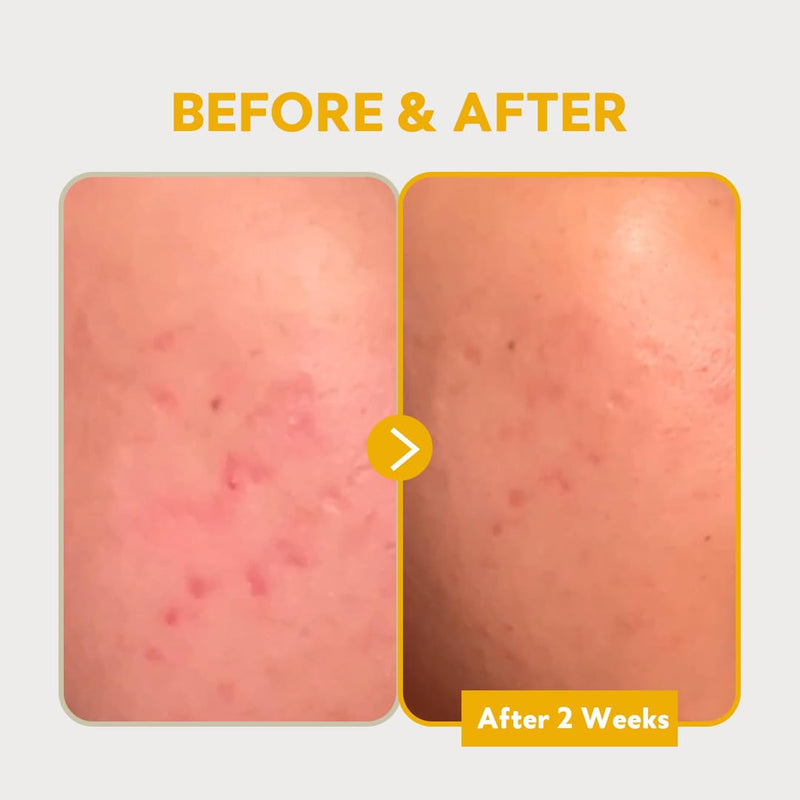 PURE VITAMIN C 24% SERUM 30ml
