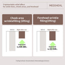 Retinol Collagen Cream Lifting Mask (10 Counts)