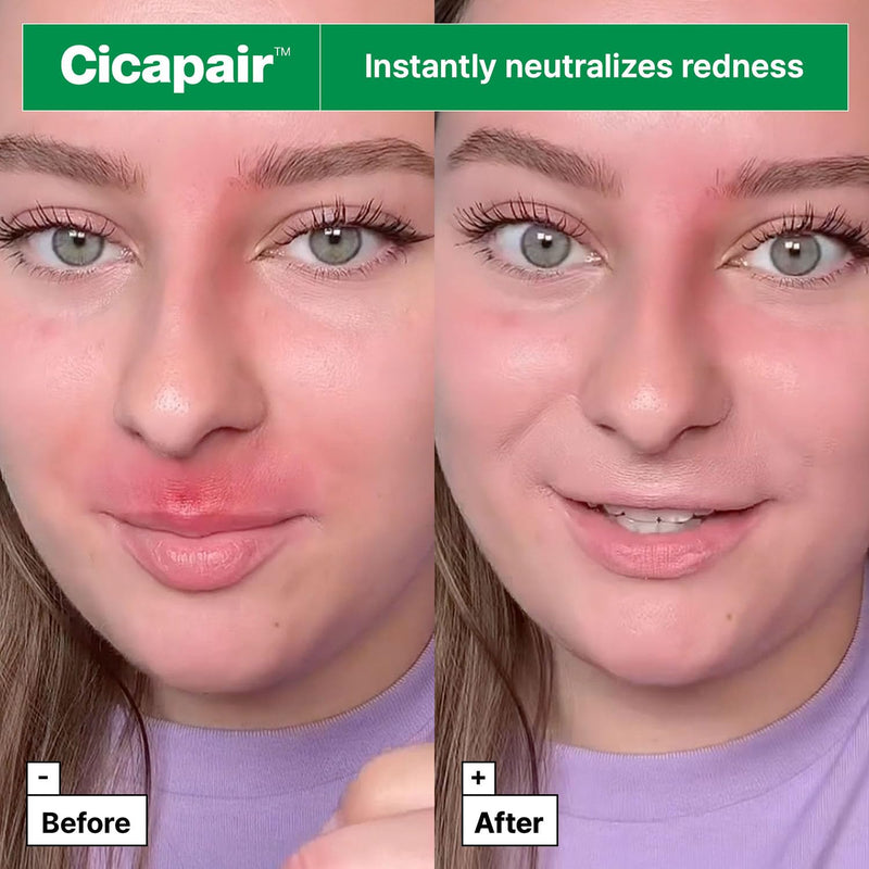 Cicapair Tiger Grass Color Correcting Treatment 15ml
