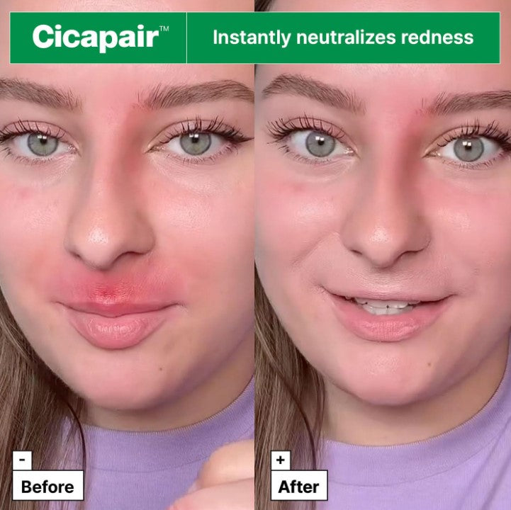 Cicapair Tiger Grass Color Correcting Treatment 50ml
