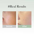 Holy Hyssop Serum 30 50ml