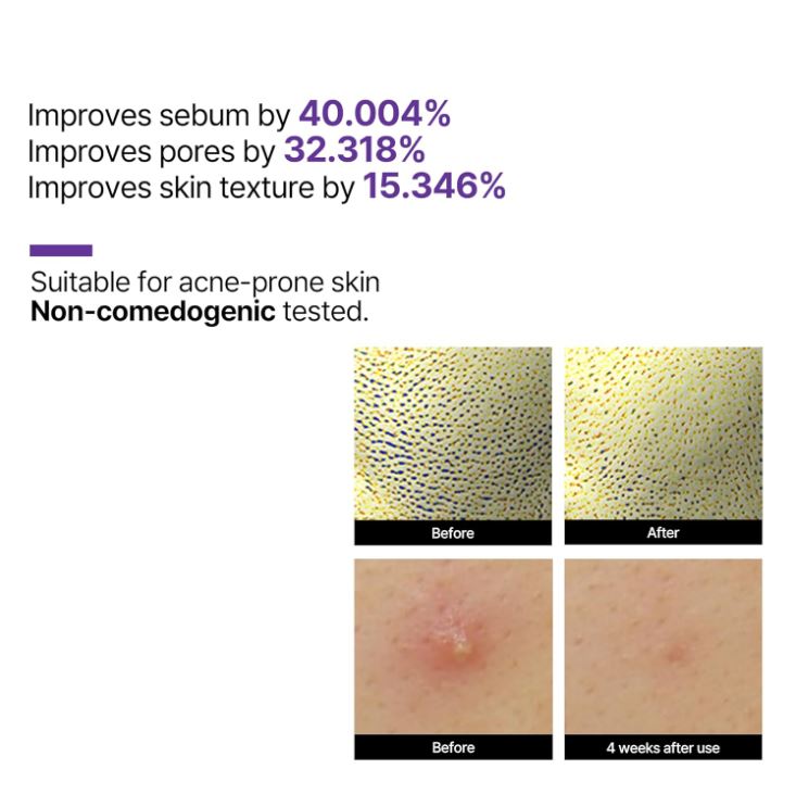 Retinol Intense Reactivating Serum 30ml/50ml