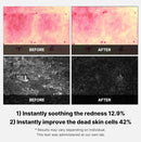 Super Cica Facial Toner Pads 70 Pads