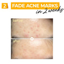 No.5+ Vitamin Concentrated Serum 30ml / 1.01 fl. oz.